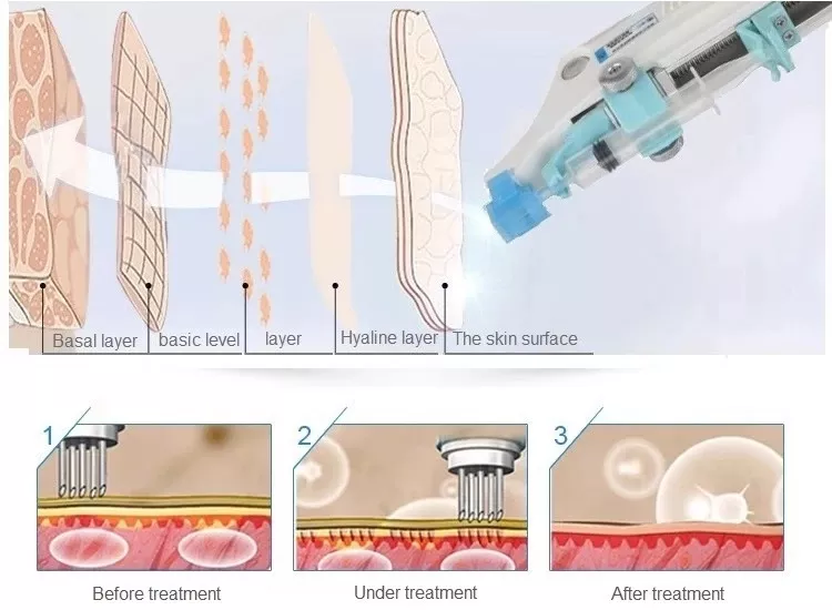 Mesogun (2)